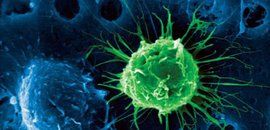 糖尿病周圍神經病變