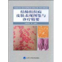 結締組織病皮膚表現圖鑑與診療精要 結締組織病皮膚表現圖鑑與診療精要