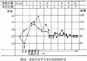 （圖）毒性瀰漫性甲狀腺腫
