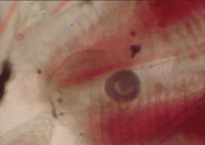 小瓜蟲包囊階段