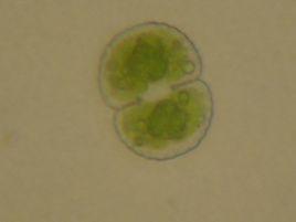 單角盤星藻 單角盤星藻
