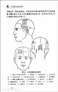 穴位電興奮療法
