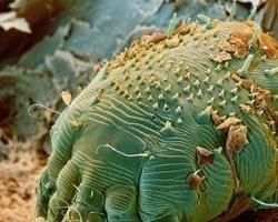 hiv感染者 hiv感染者