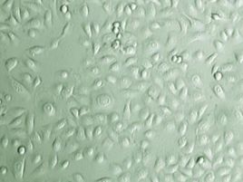 尿常規上皮細胞 尿常規上皮細胞