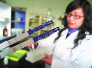愛滋病唾液檢測試劑使用方法