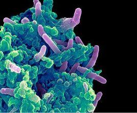 超級淋病細菌 超級淋病細菌