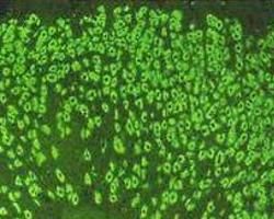 抗胃壁細胞抗體 抗胃壁細胞抗體