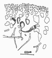 果胞枝，輔助細胞及連絡絲切面觀