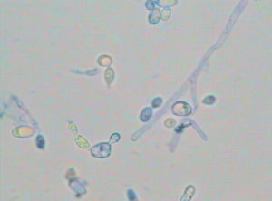 白色假絲酵母菌