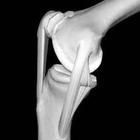 後十字韌帶損傷 後十字韌帶損傷