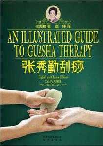 張秀勤刮痧 張秀勤刮痧