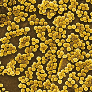 金黃葡萄球菌