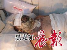 10&middot;30黑龍江密山拆遷自焚事件