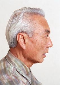 老年急性動脈栓塞