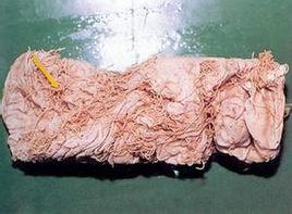 豬鞭蟲病 豬鞭蟲病