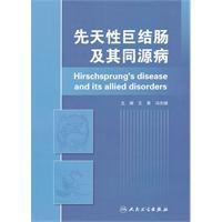 先天性巨結腸及其同源病 先天性巨結腸及其同源病