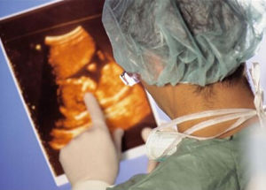 羊水過多症 羊水過多症