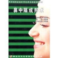 鼻中隔成形術 鼻中隔成形術