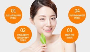 內眼角修復術對象