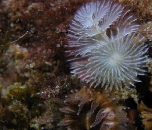 旋毛管蟲 旋毛管蟲