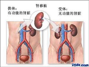 燒傷後急性腎功能衰竭