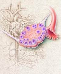 卵巢交界性腫瘤