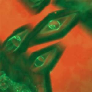 冰結構蛋白 冰結構蛋白