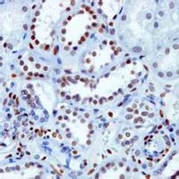 抗磷脂抗體 抗磷脂抗體