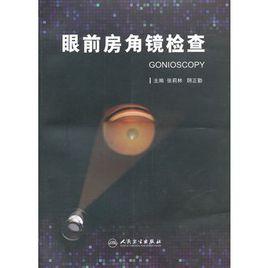 眼前房角鏡檢查 眼前房角鏡檢查