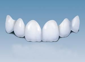 納米仿生美容冠