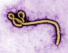 伊波拉病毒結構形態