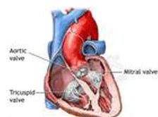 第三心音 第三心音