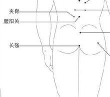 尾閭穴亦稱長強穴