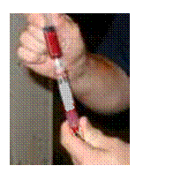 紅細胞孵育滲透脆性試驗