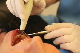 手術拔牙 手術拔牙