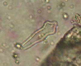 窄異極藻 窄異極藻