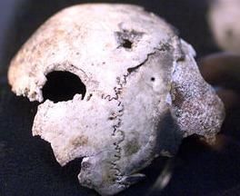 希特勒頭骨 希特勒頭骨