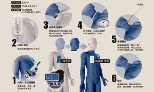 換頭手術 換頭手術