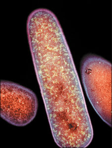 難辨梭狀芽孢桿菌