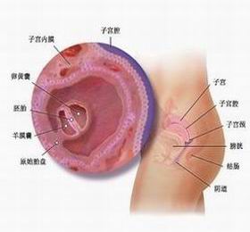 羊膜腔感染綜合徵
