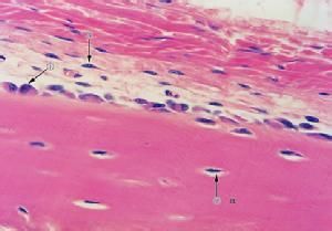 造骨細胞 造骨細胞