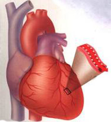 老年人急性心肌梗死