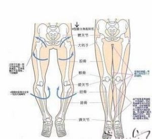 O型腿塑形術效果圖