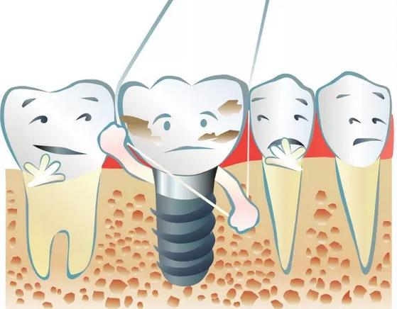 為什麼有些人口臭嚴重卻不自知?