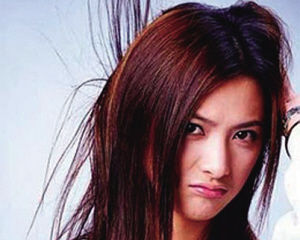 女性型脫髮 女性型脫髮