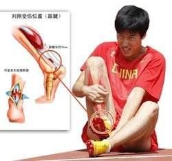 運動創傷 運動創傷