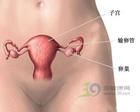 妊娠合併宮頸癌