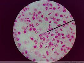 星座鏈球菌 星座鏈球菌