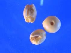 不完善粒 不完善粒