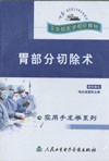 《胃部分切除術》 《胃部分切除術》